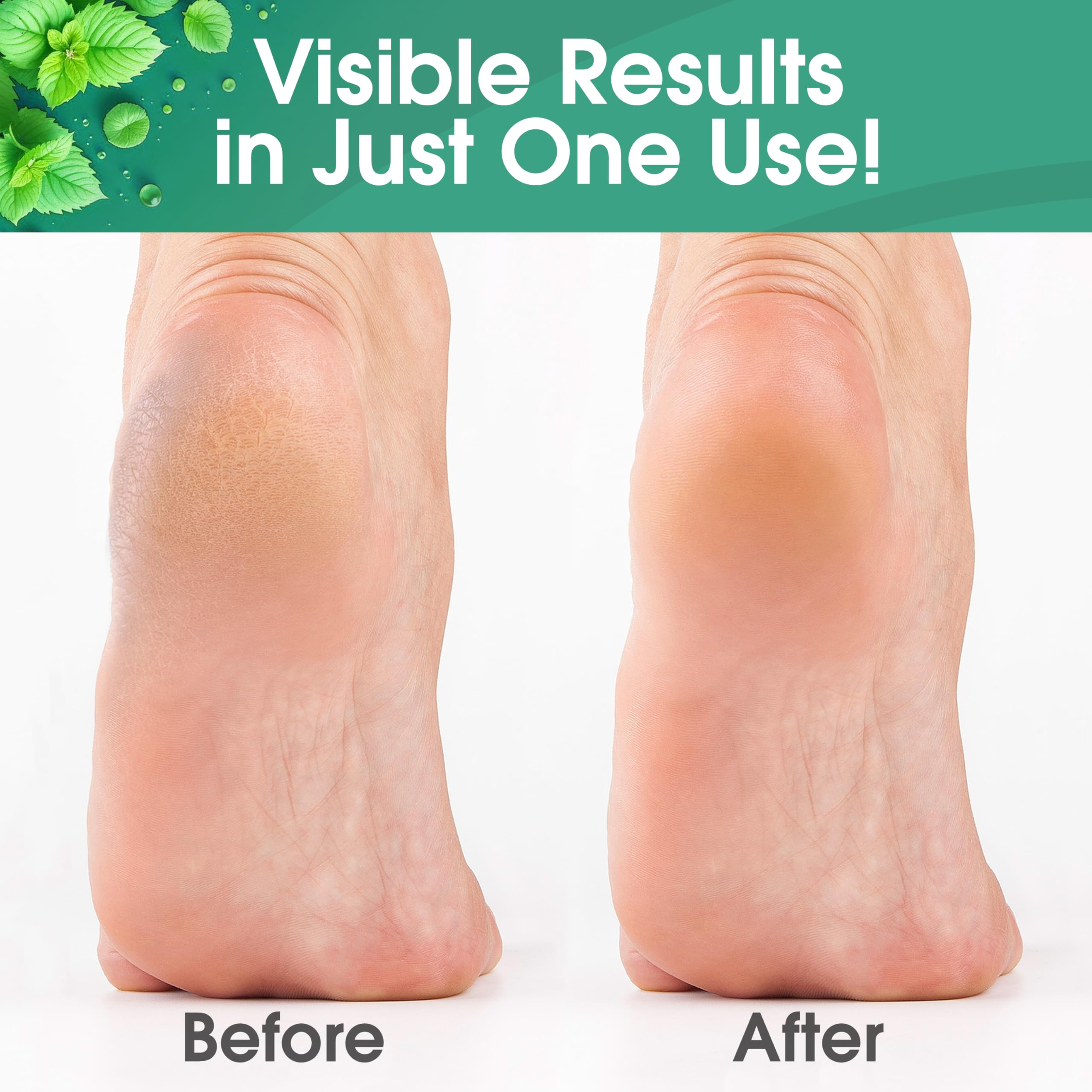 Foot callus remover gel for feet at home pedicure DeEnti