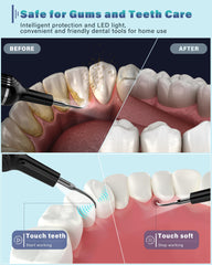 Dental Cleaning Kit with LED Light showing tartar removal capabilities