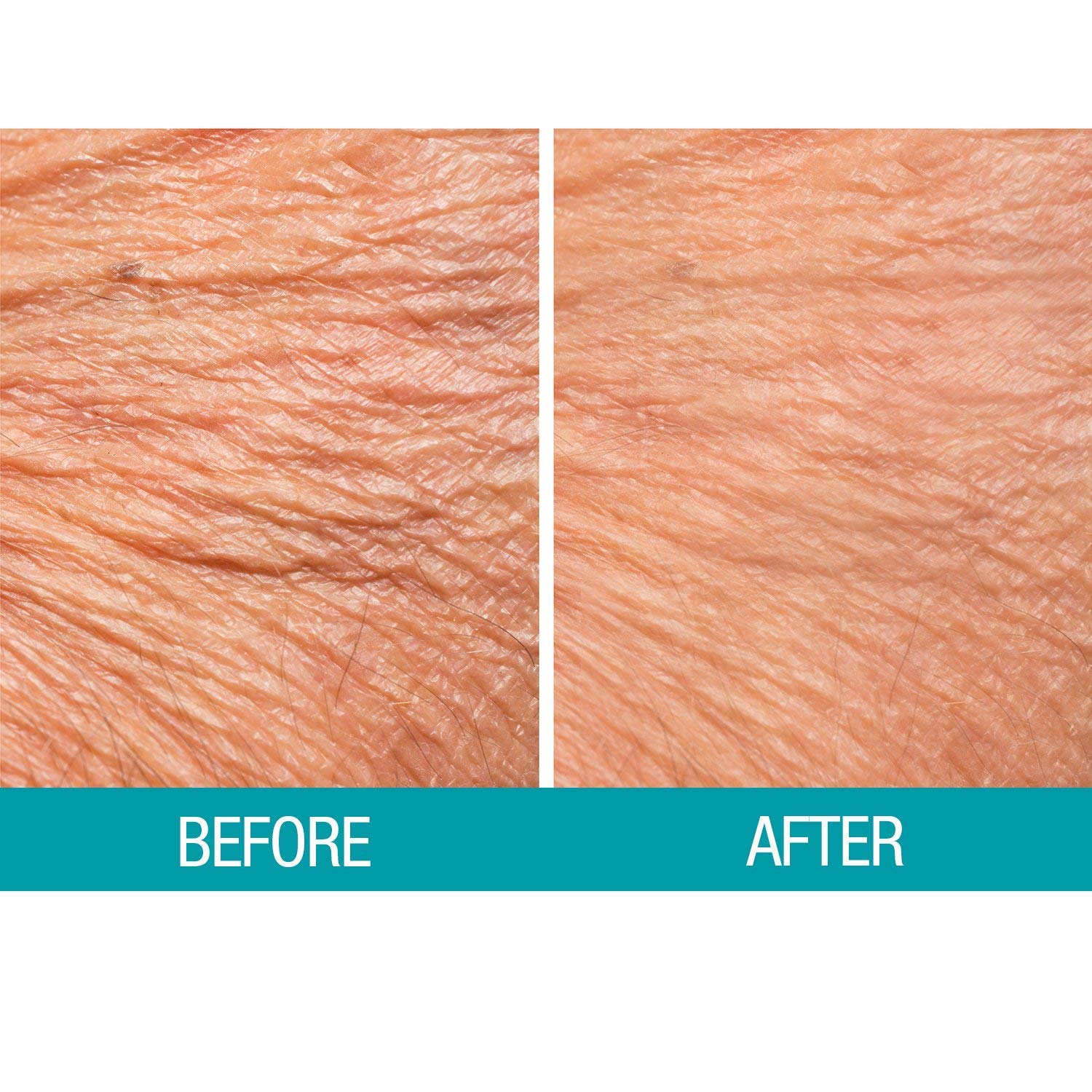 Made in USA Dermactin Crepe Skin Care classic