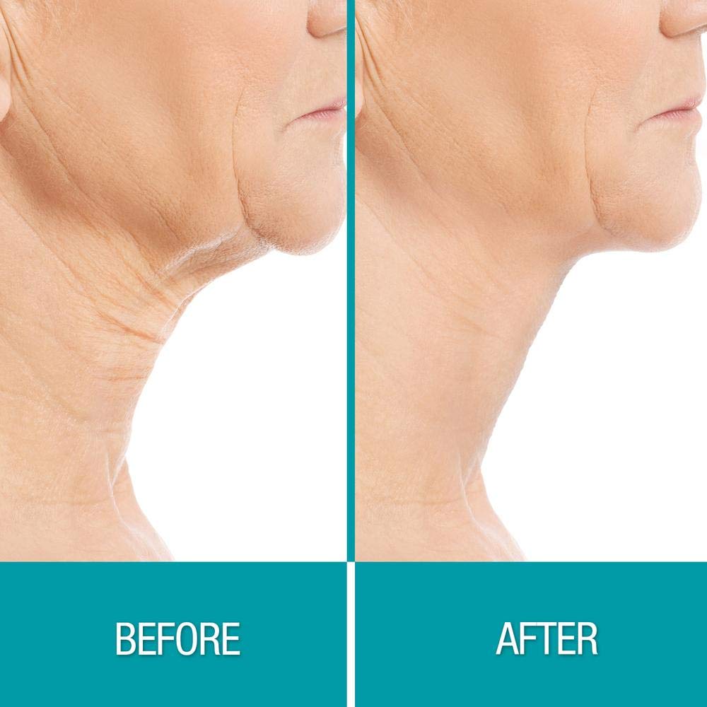 Dermactin plant extracts neck cream