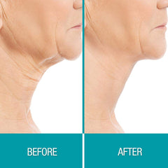Dermactin plant extracts neck cream