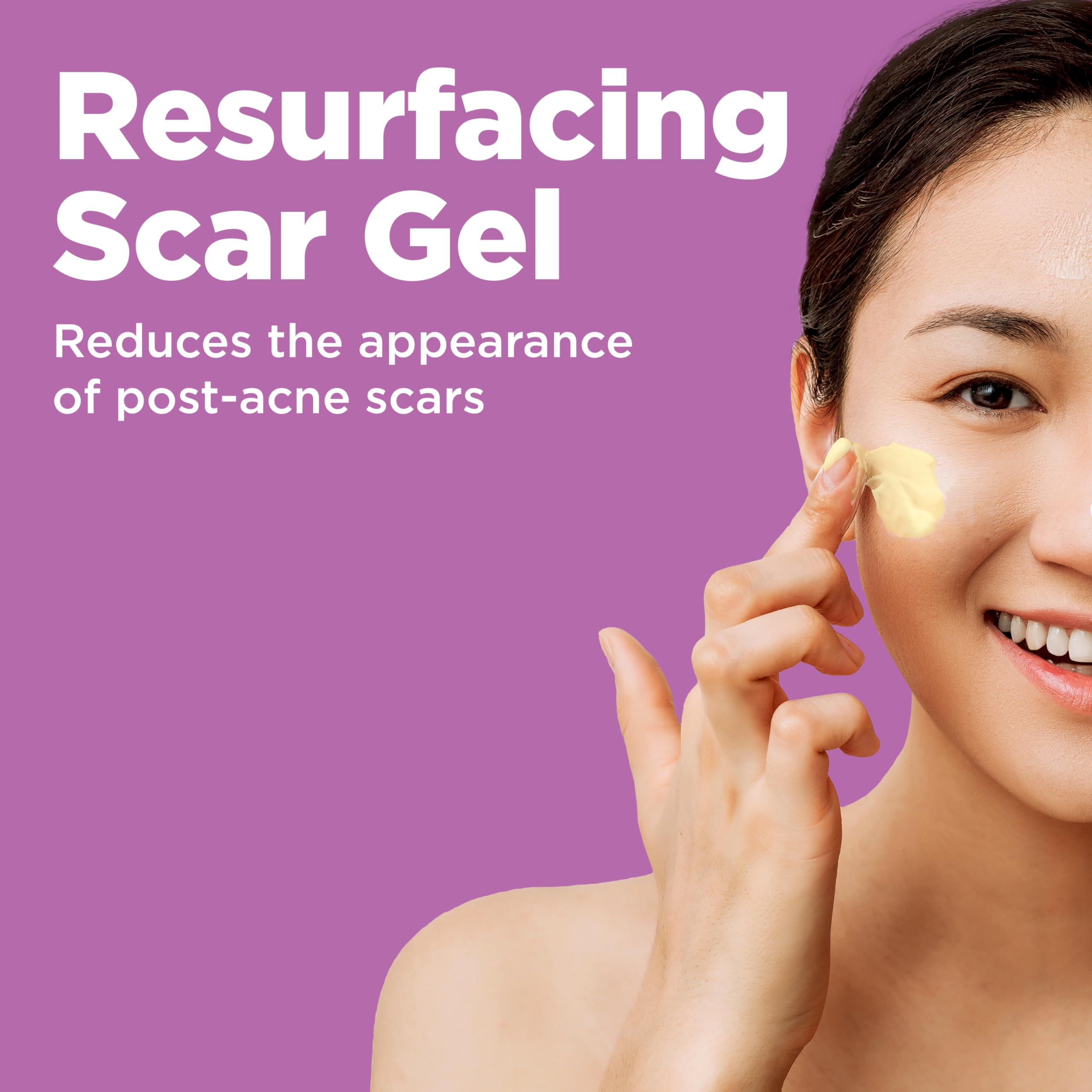 Differin Resurfacing Acne Scar Treatment Gel for Face packaging