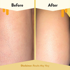 Leaping Bunny cruelty-free Eczema Honey product image
