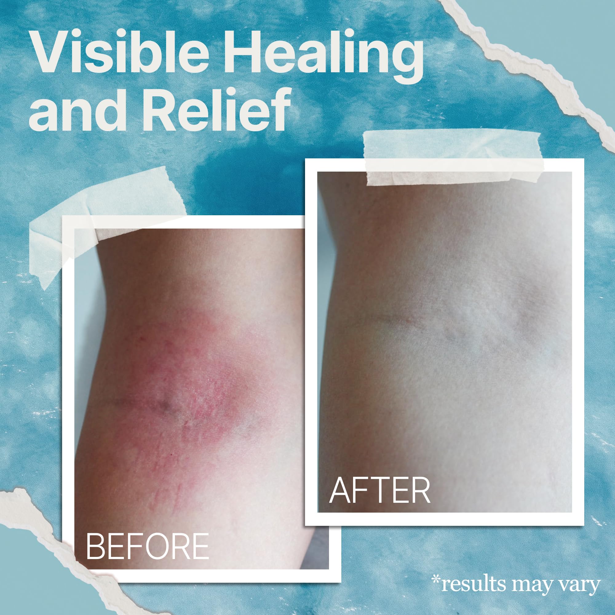 Eczema and psoriasis relief cream with sea moss