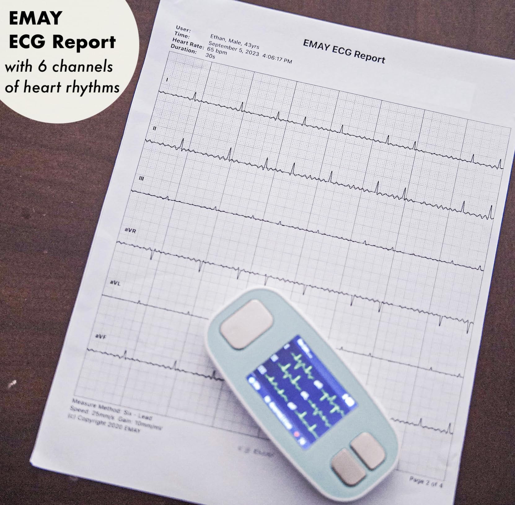 EMAY 6L ECG monitor case upload and review features