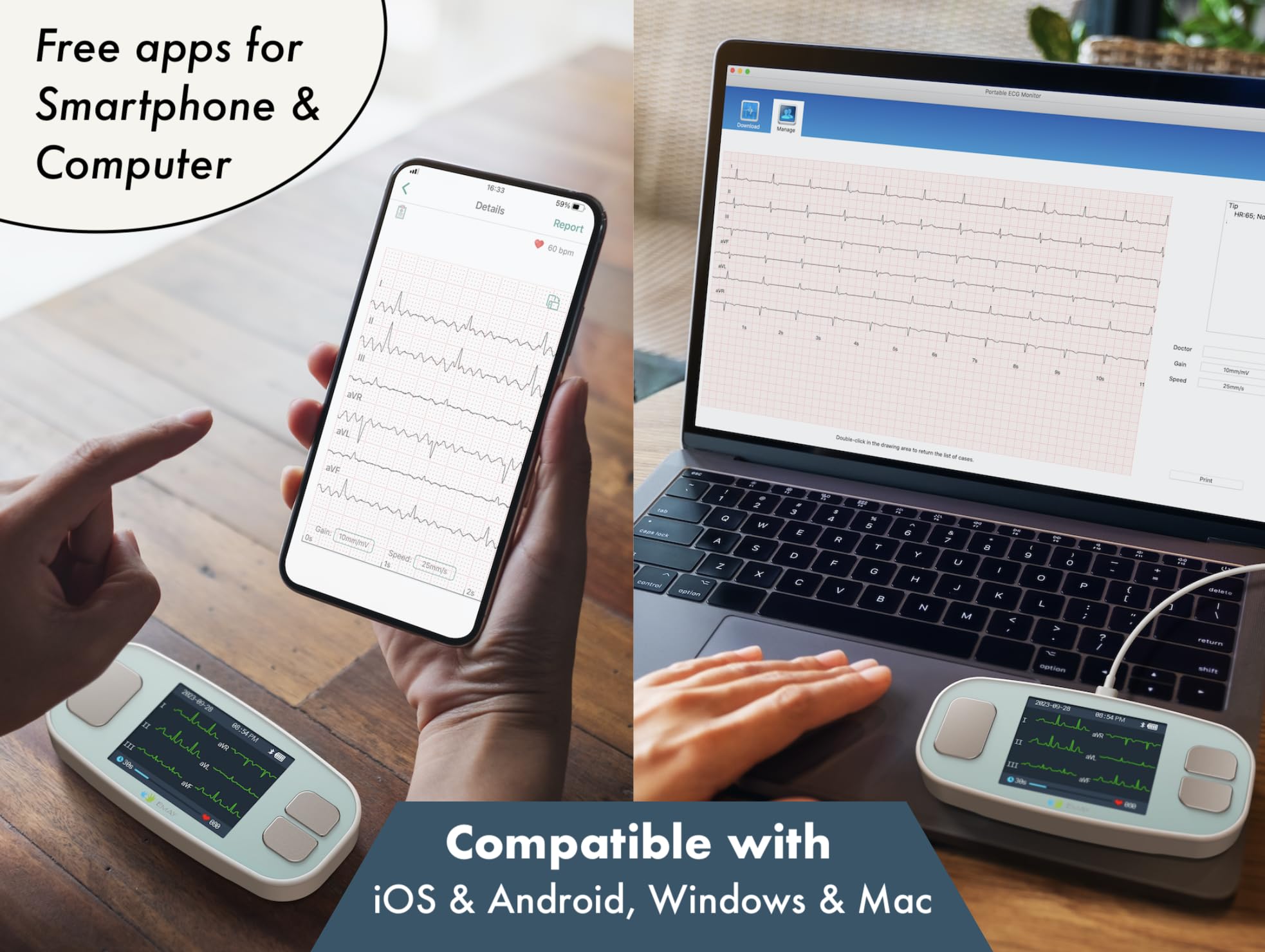 EMAY 6L portable ECG monitor packaging and USB cable