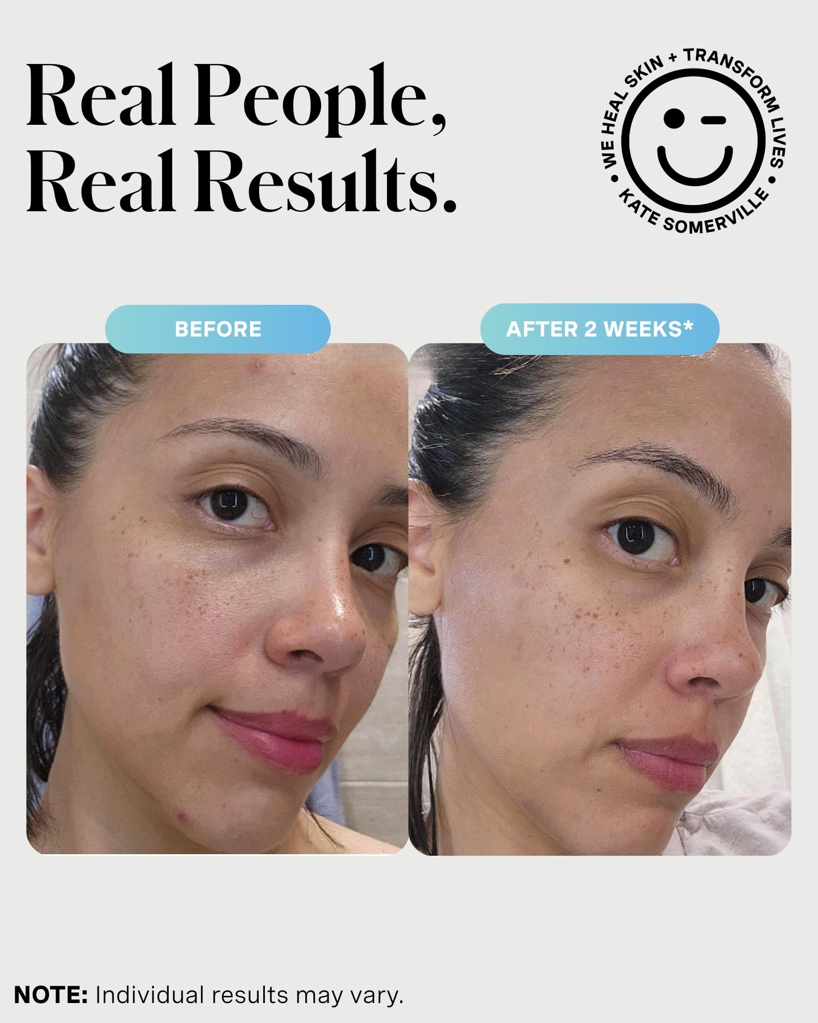 Kate Somerville EradiKate sulfur acne treatment from Hollywood clinic