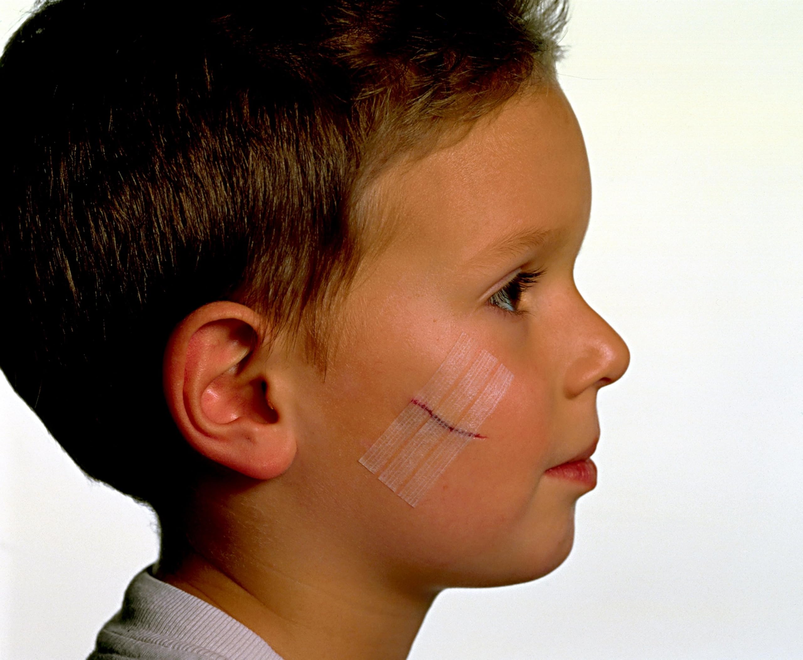 Nexcare Steri-Strip breathable adhesive strips