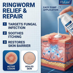 Flyleaf ringworm treatment cream 3.53oz