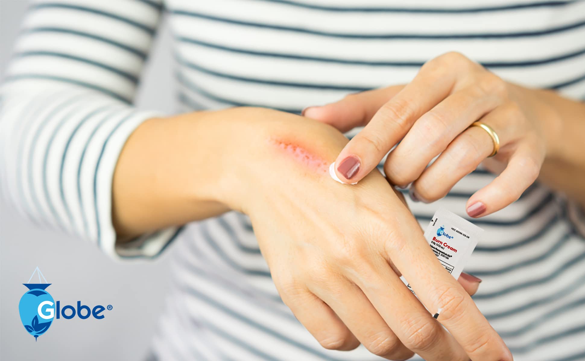 Contains Lidocaine and Benzalkonium in the cream