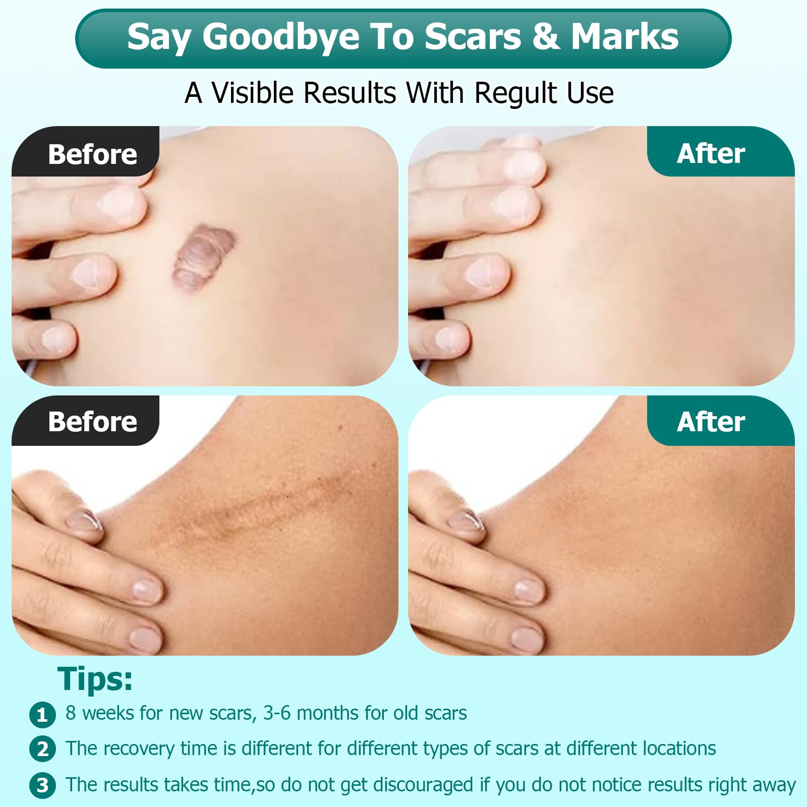 Gowgaw Scar Gel ingredients retinol allantoin vitamin E