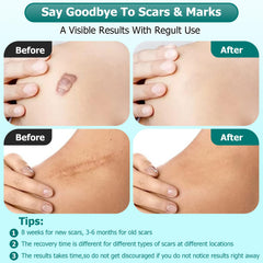 Gowgaw Scar Gel ingredients retinol allantoin vitamin E