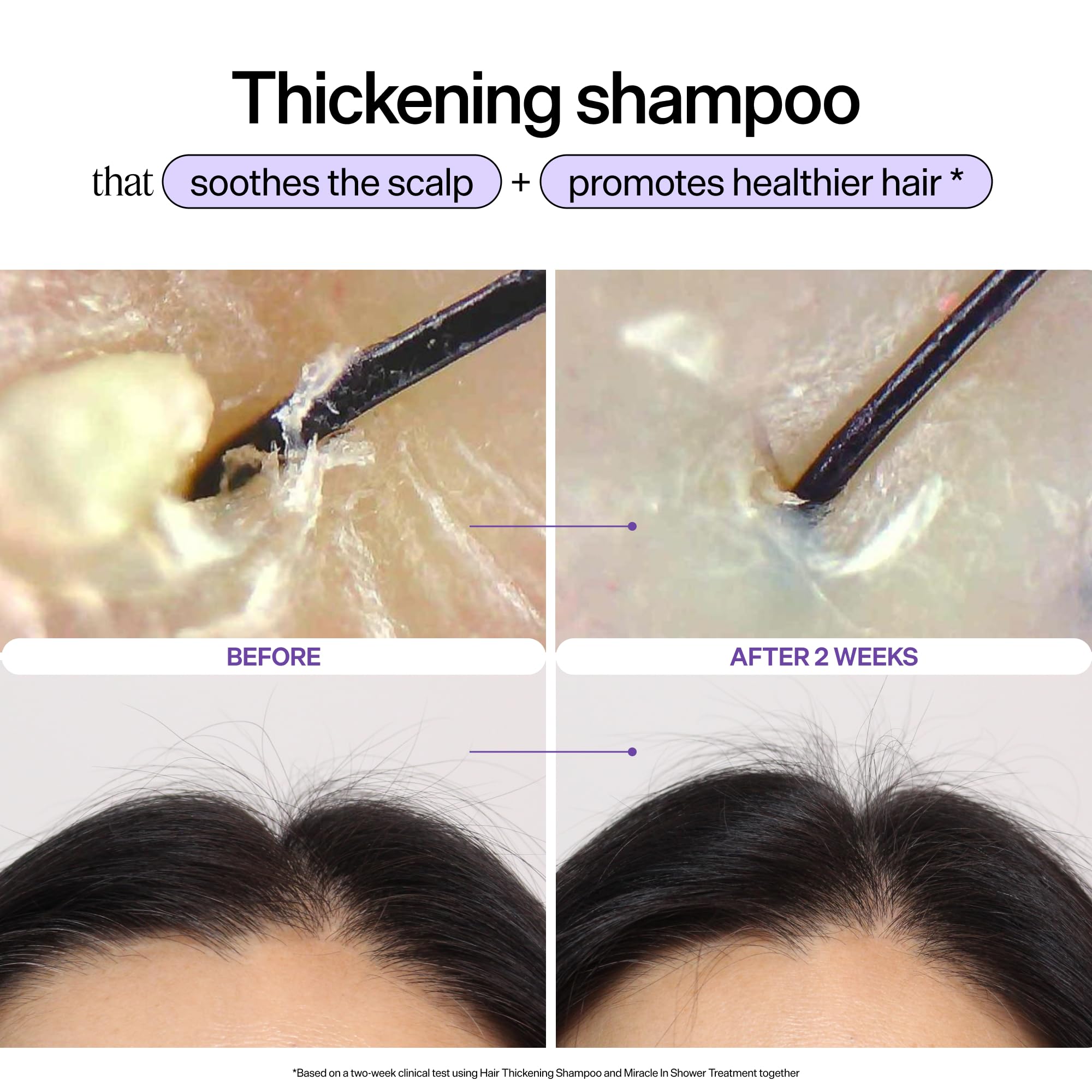 Hair Thickening Shampoo bottle with rosemary oil