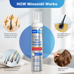 Minoxidil foam for beard application