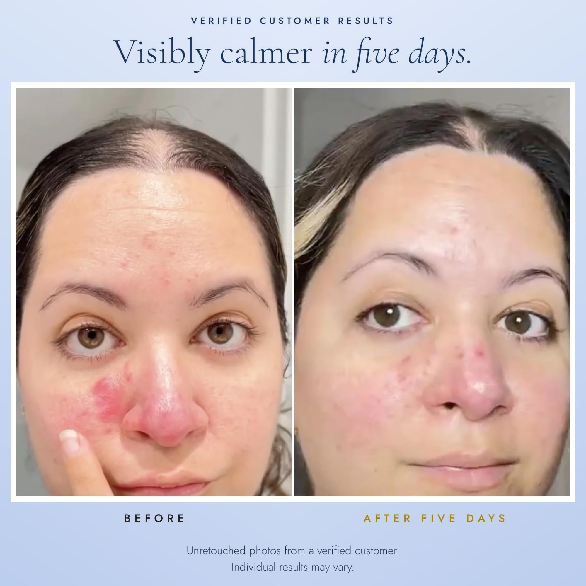Hey Honey Skincare Relax Rosacea Relief Cream 2.4 oz tube