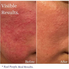 Hey Honey Skincare Relax Instant Rosacea Relief Cream product box