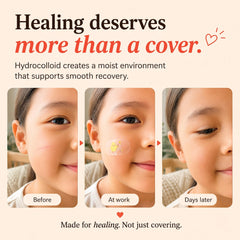 Adventure Collection Kissprinkle moistureband assorted shapes 35 count