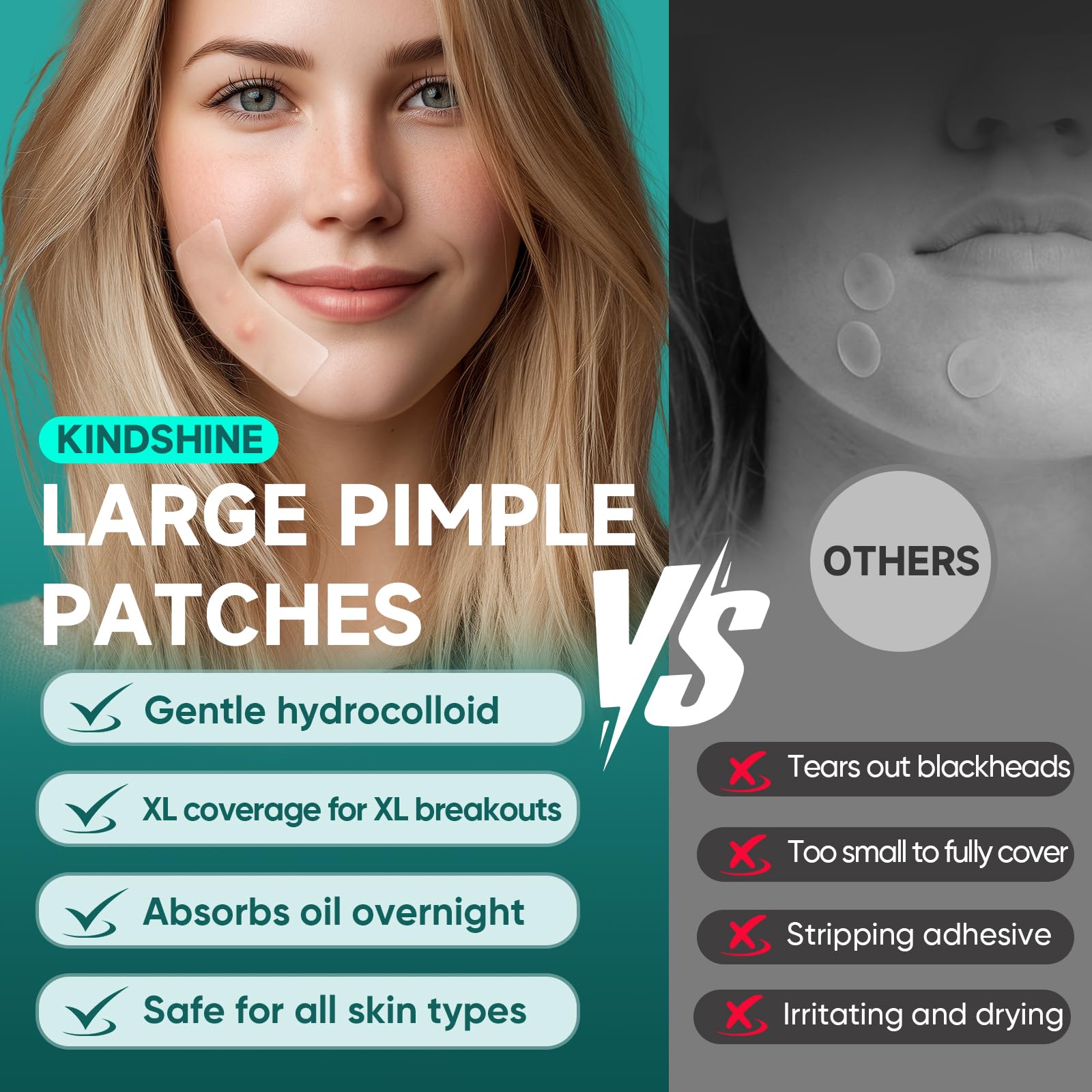 discreet thin hydrocolloid patches suitable for daytime wear