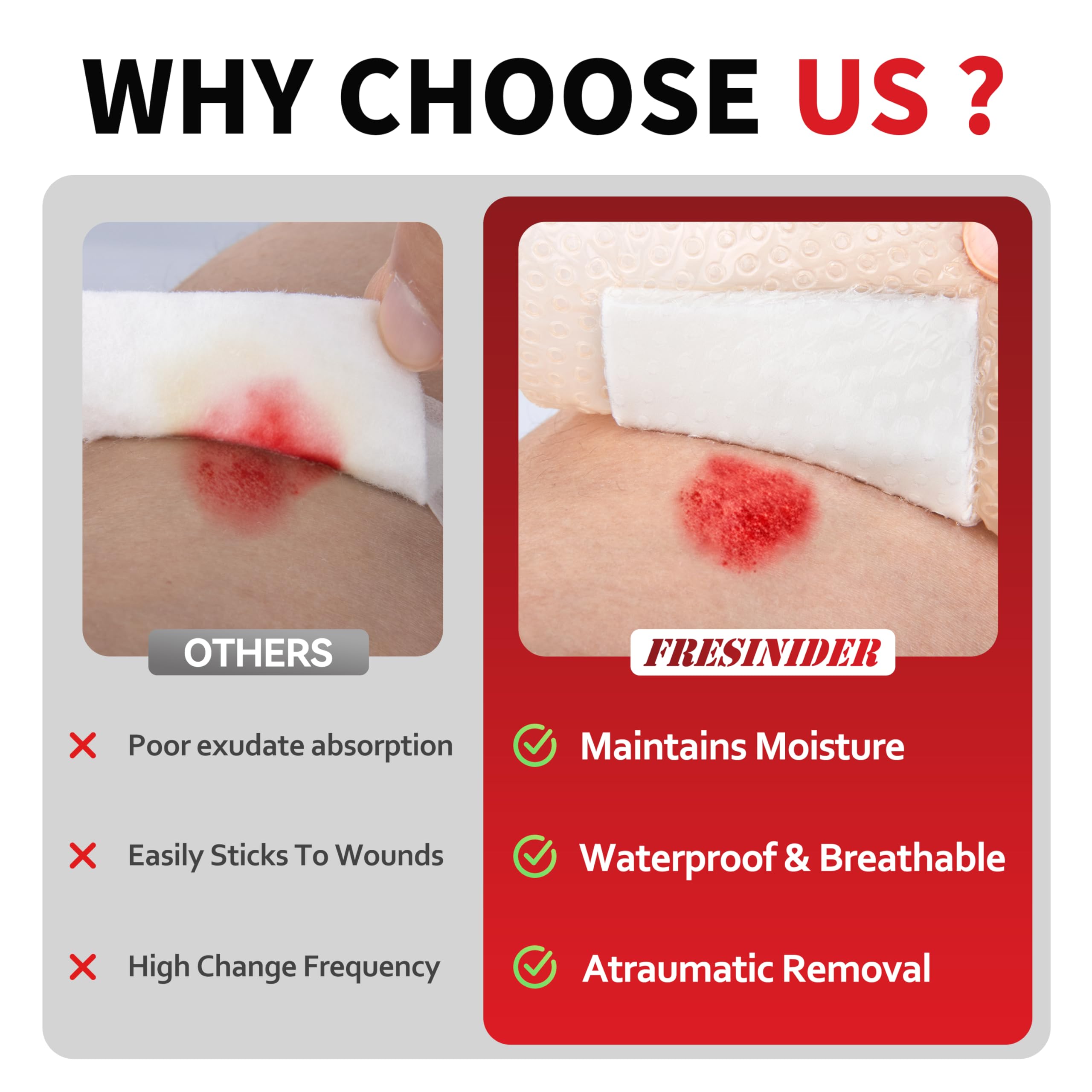 Pack of 10 large waterproof wound dressings for exuding wounds