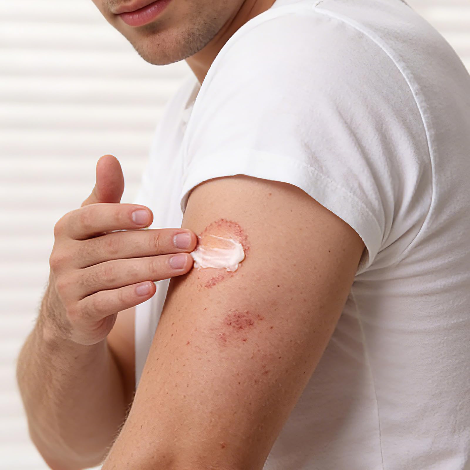 Compact 100g Kerova antifungal cream packaging
