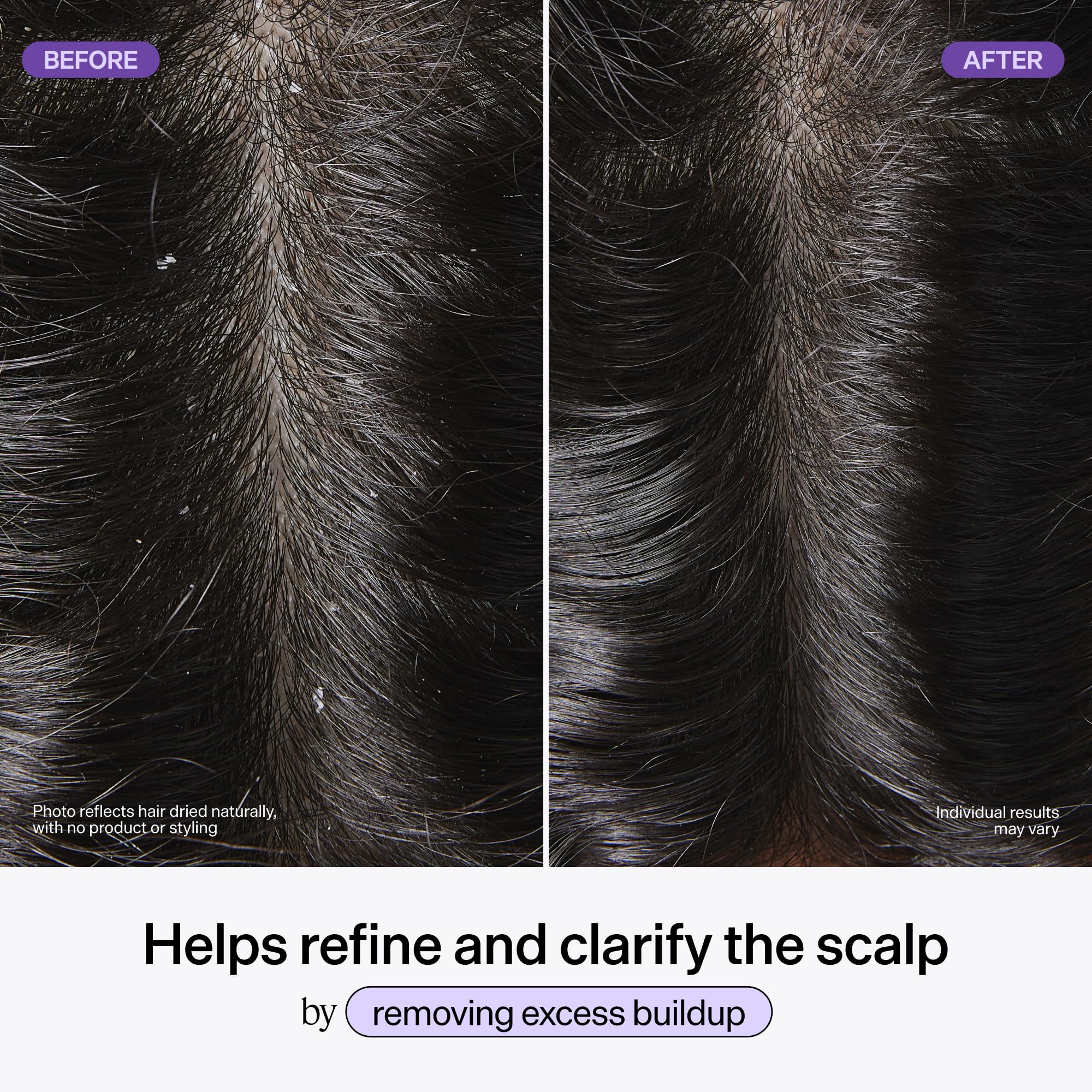 Korean hair care Dr Groot scalp treatment packaging