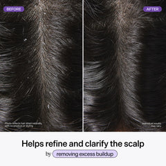 Korean hair care Dr Groot scalp treatment packaging