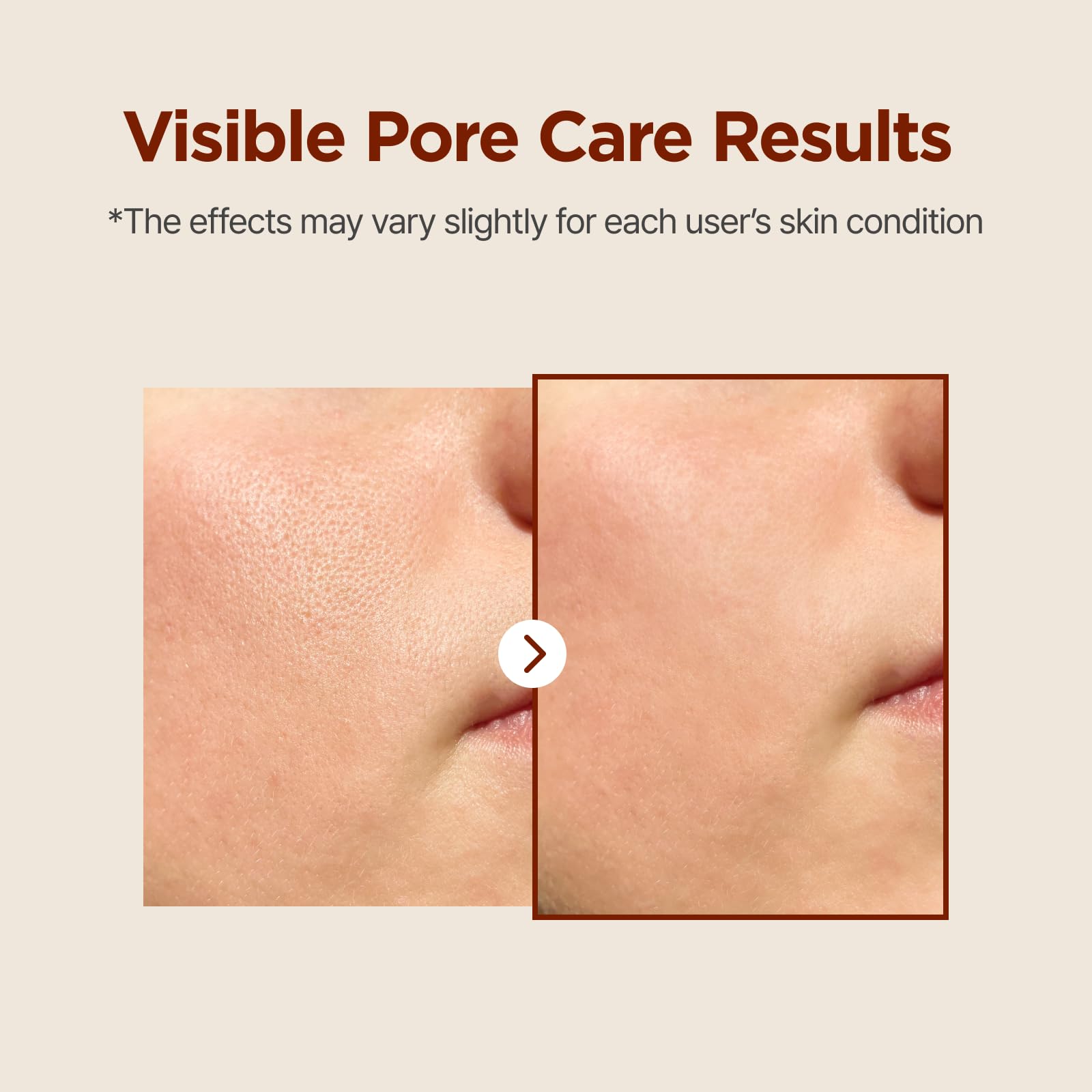 Toner for oily skin with sebum control feature