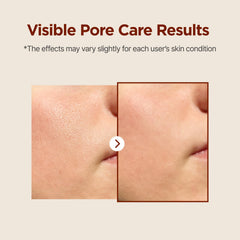 Toner for oily skin with sebum control feature