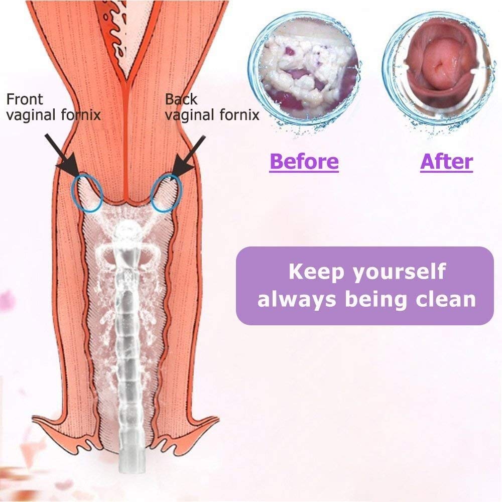 Three nozzle tips included for vaginal cleansing system