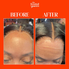 Lace wig adhesive spray The Frontal Queen close up