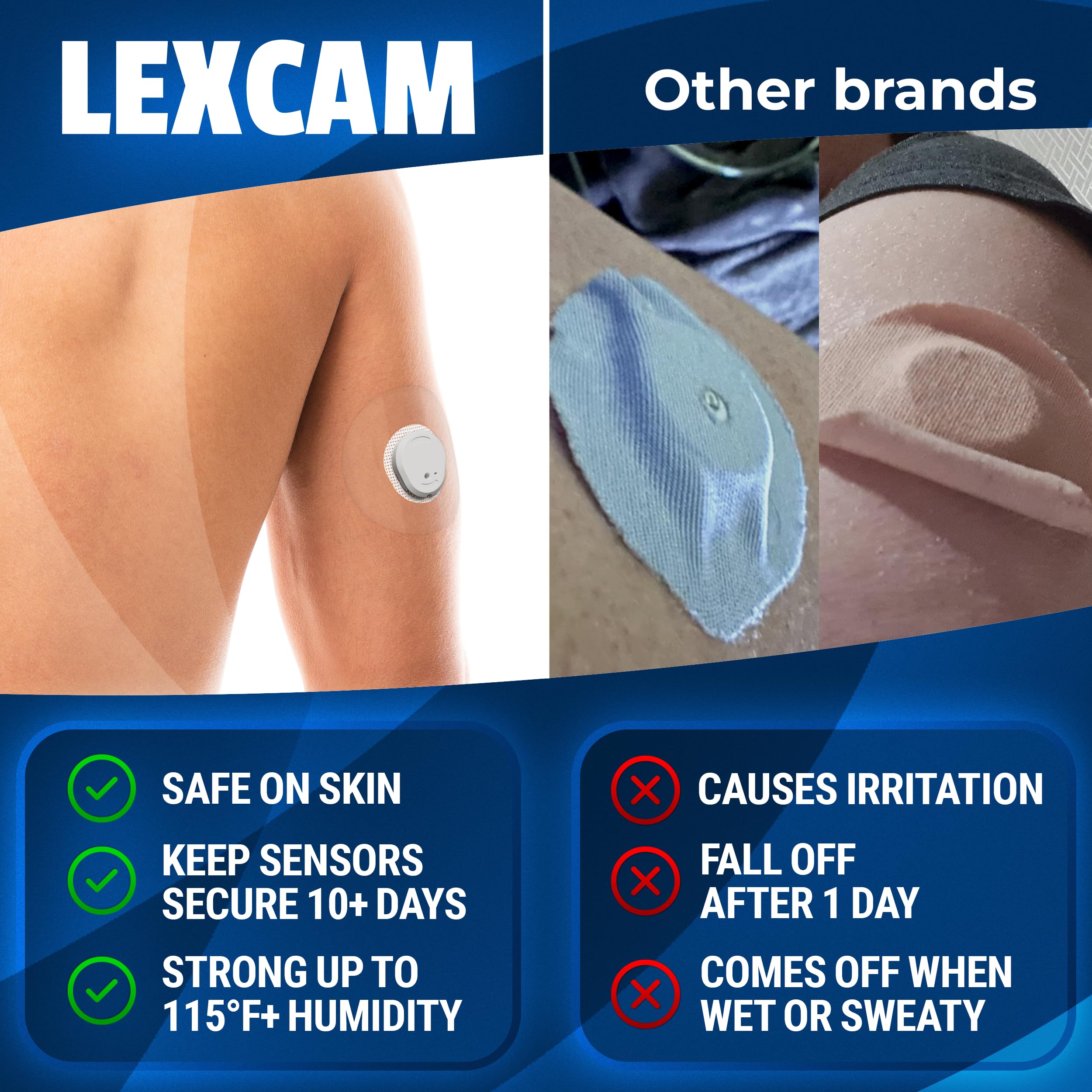 Hypoallergenic latex-free Dexcom G7 patch from Lexcam