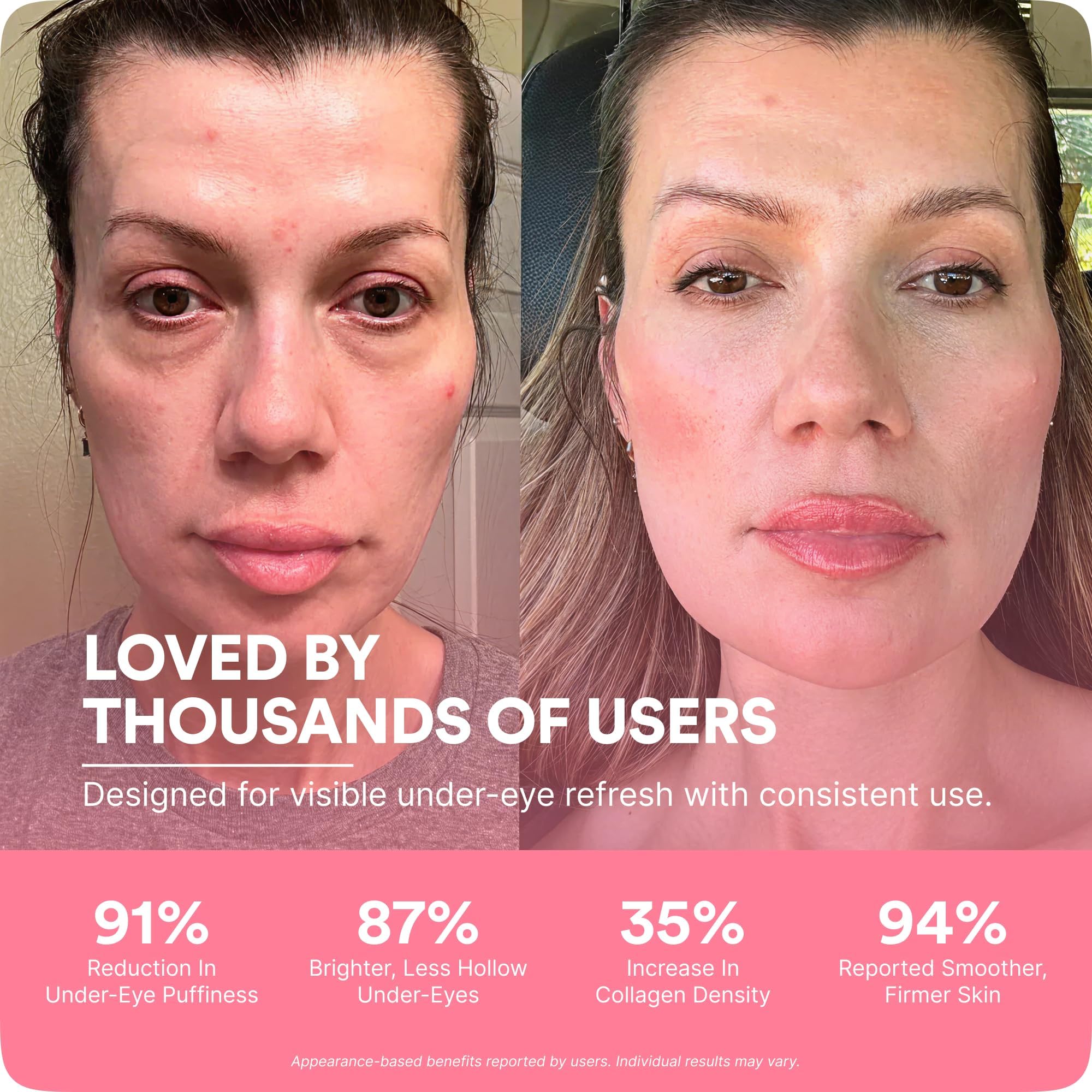 Under eye skincare tool from Botanique Paris in packaging view