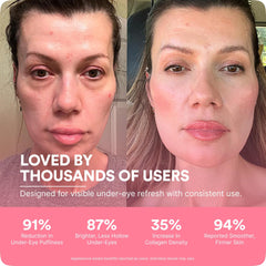 Under eye skincare tool from Botanique Paris in packaging view
