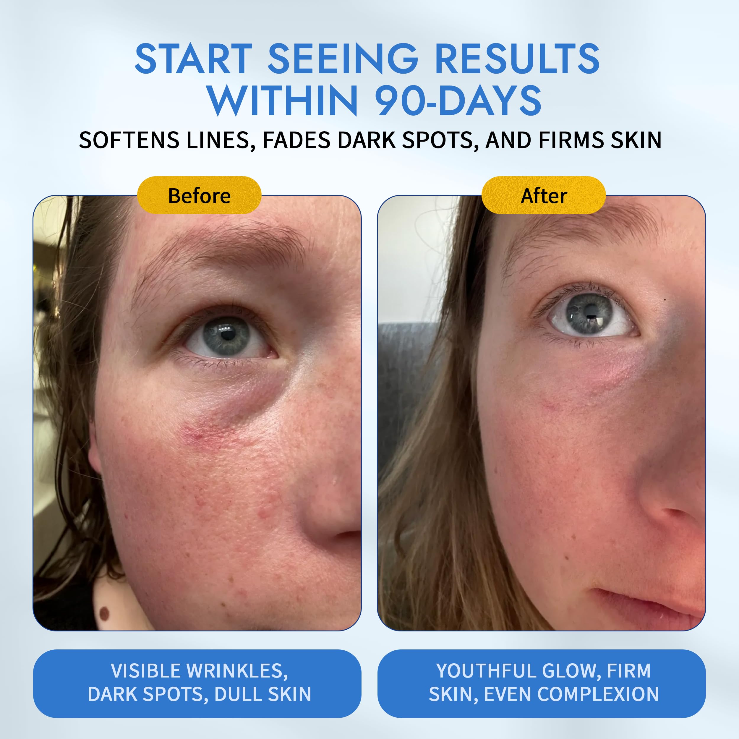 Hyaluronic acid and ceramides hydrate the serum