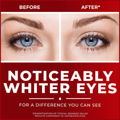 OTC eye drops Clear Eyes redness relief 0.5 oz packaging