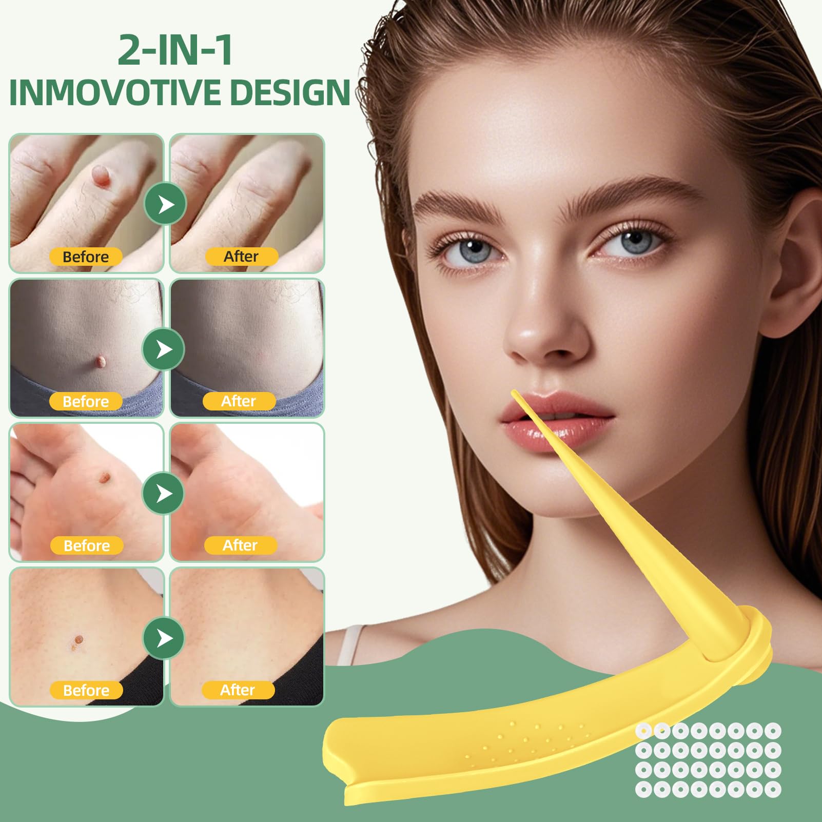 Two size options for skin tag removal shown with kit components