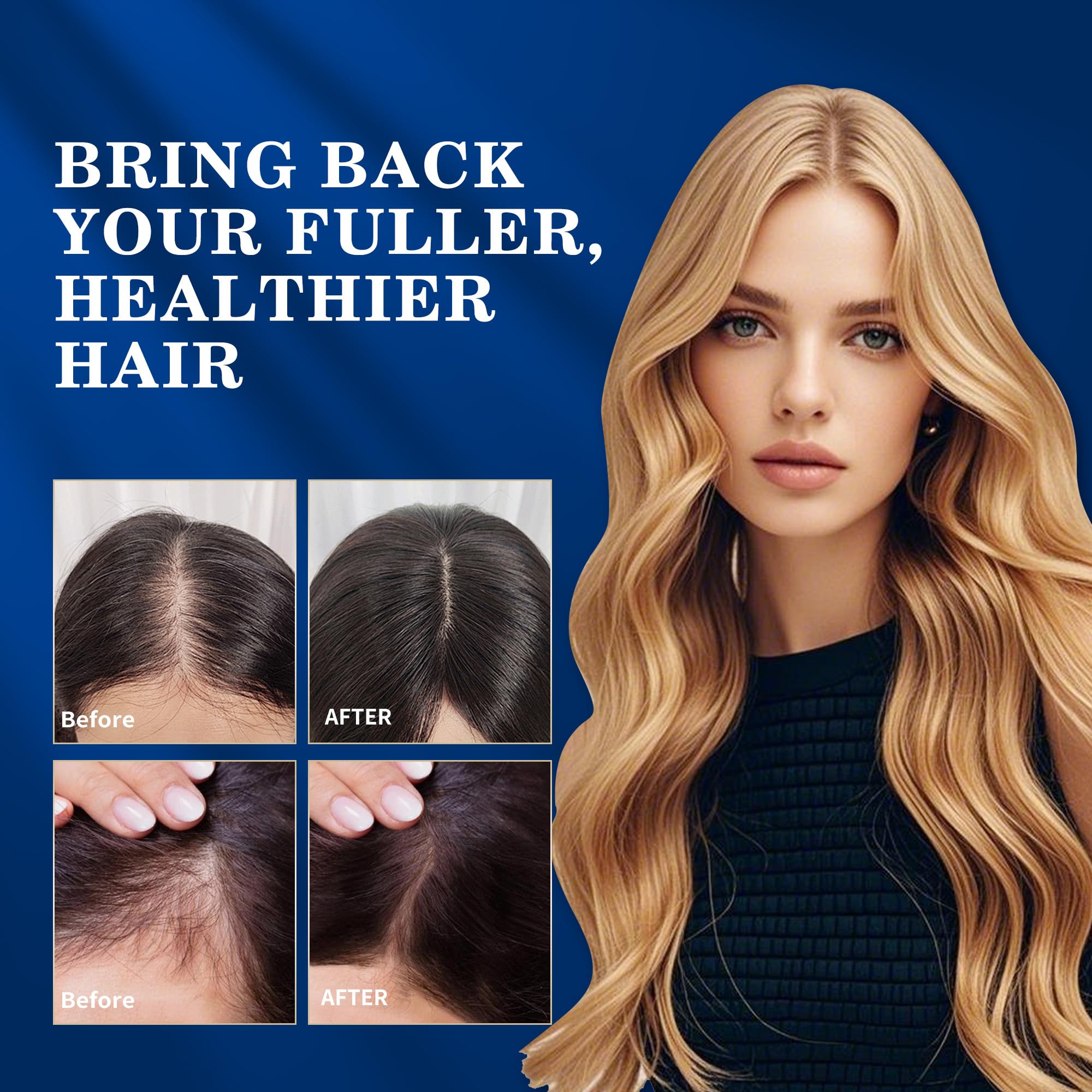biotin enriched minoxidil 5 percent kit for hair growth