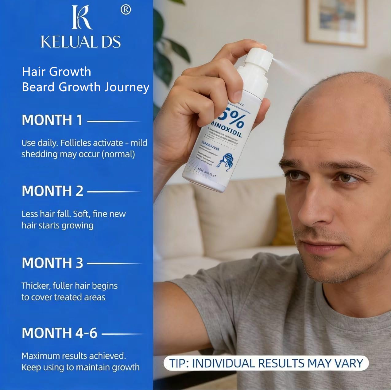 Minoxidil hair growth for both genders in 60 ml bottle