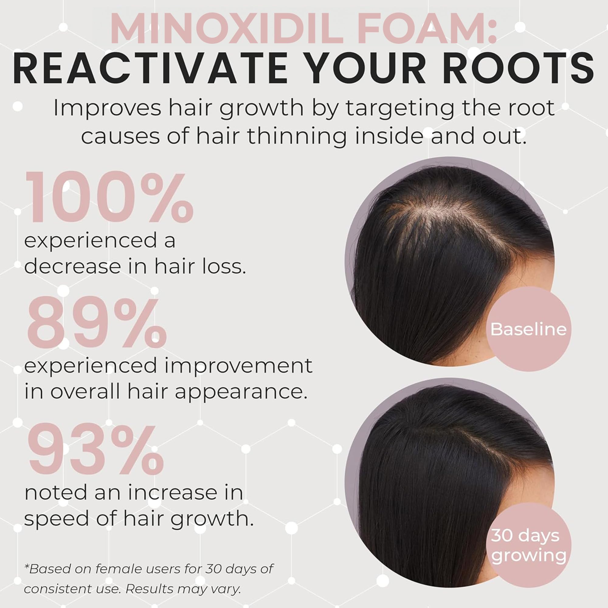 Minoxidil hair regrowth foam for women packaging