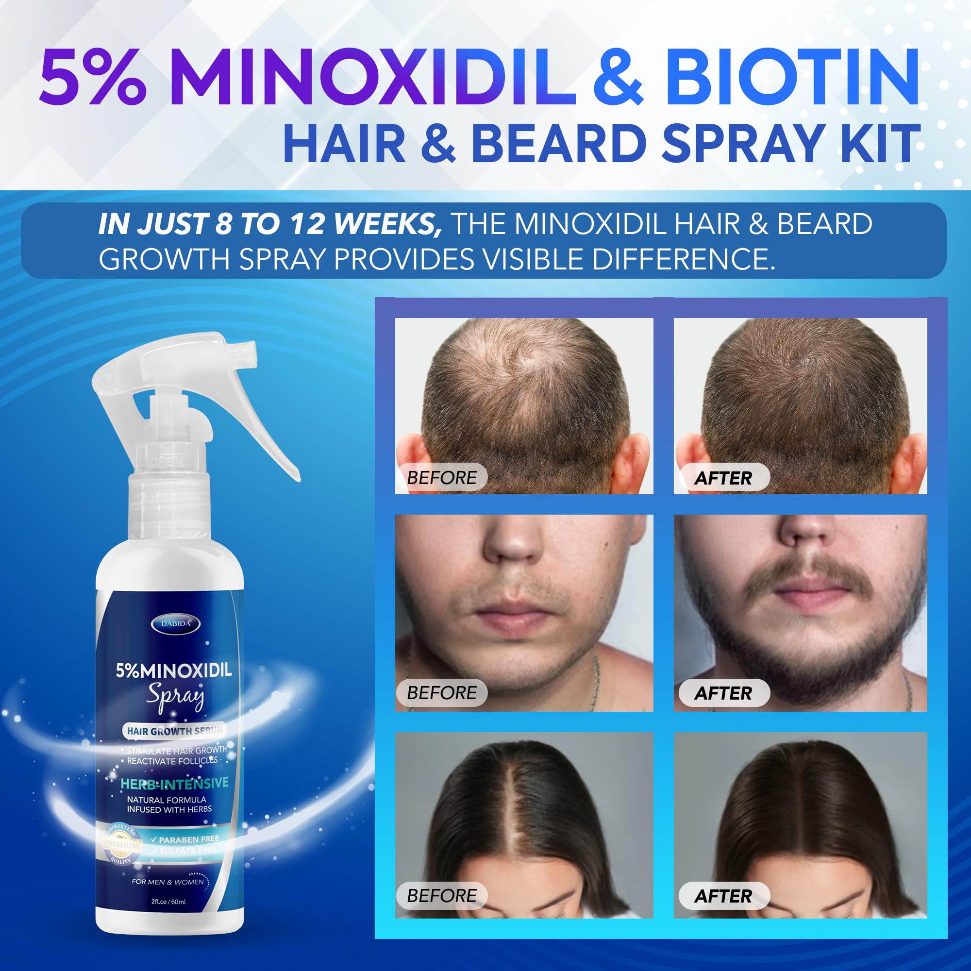 Minoxidil hair regrowth spray for women 60ml bottle