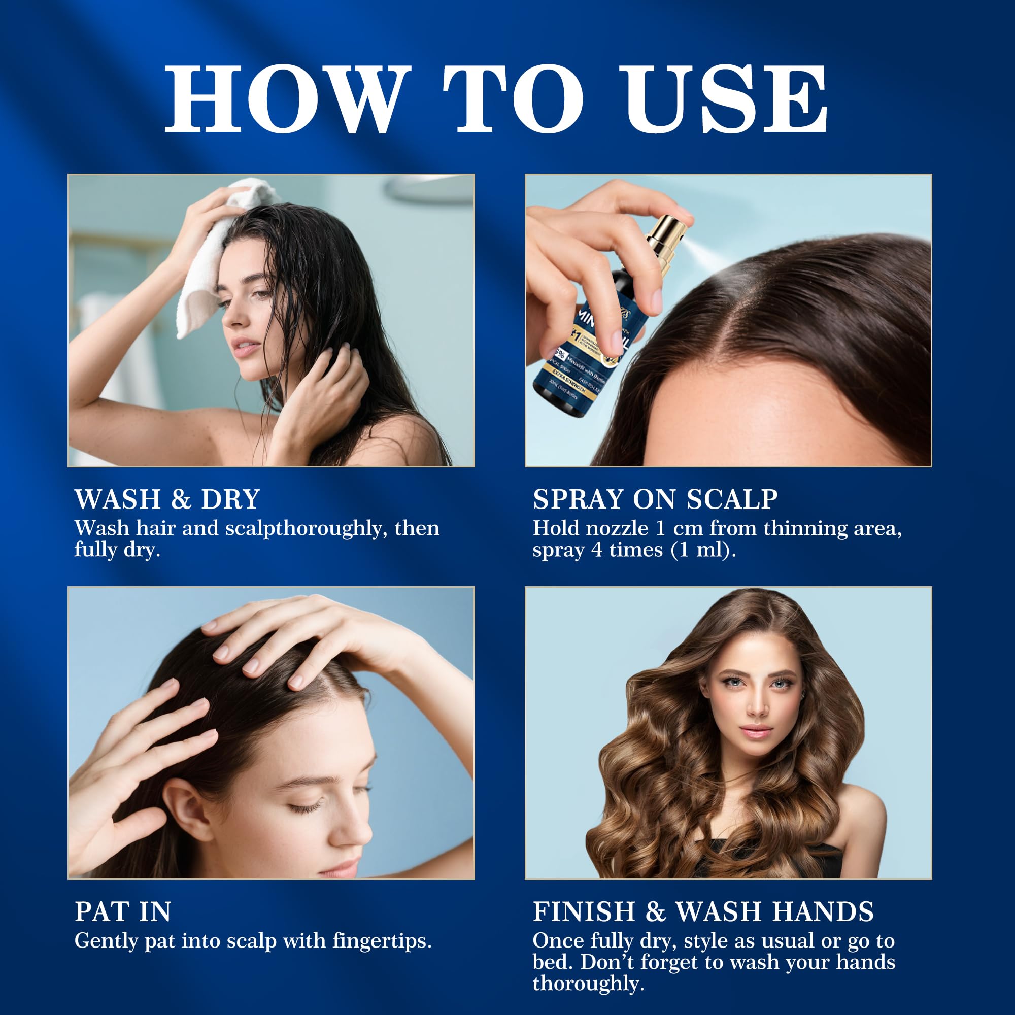 patchy scalp thinning and beard regrowth with minoxidil