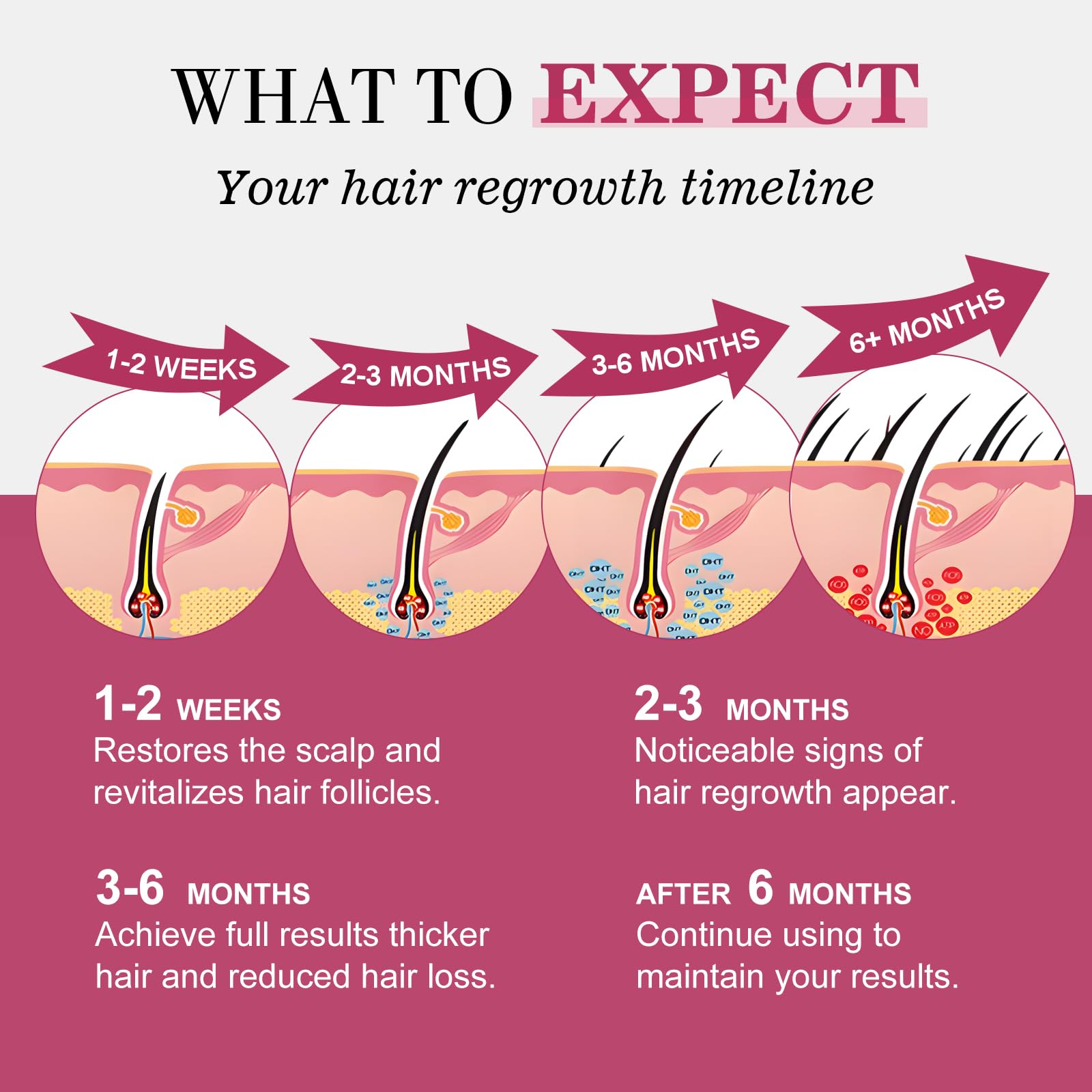 Scalp-friendly Minoxidil solution for thinning hair in women