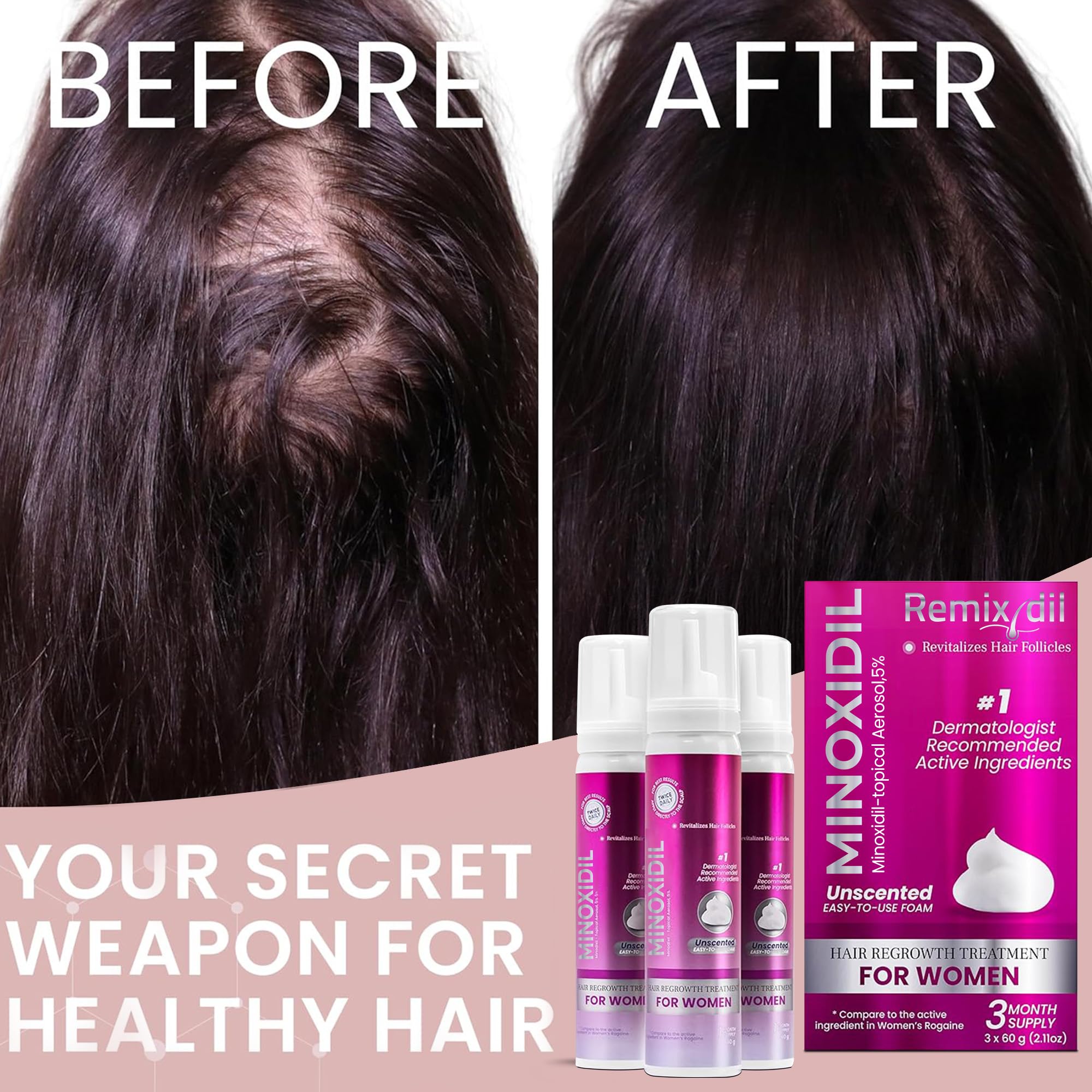 Minoxidil foam for women quick-drying formula