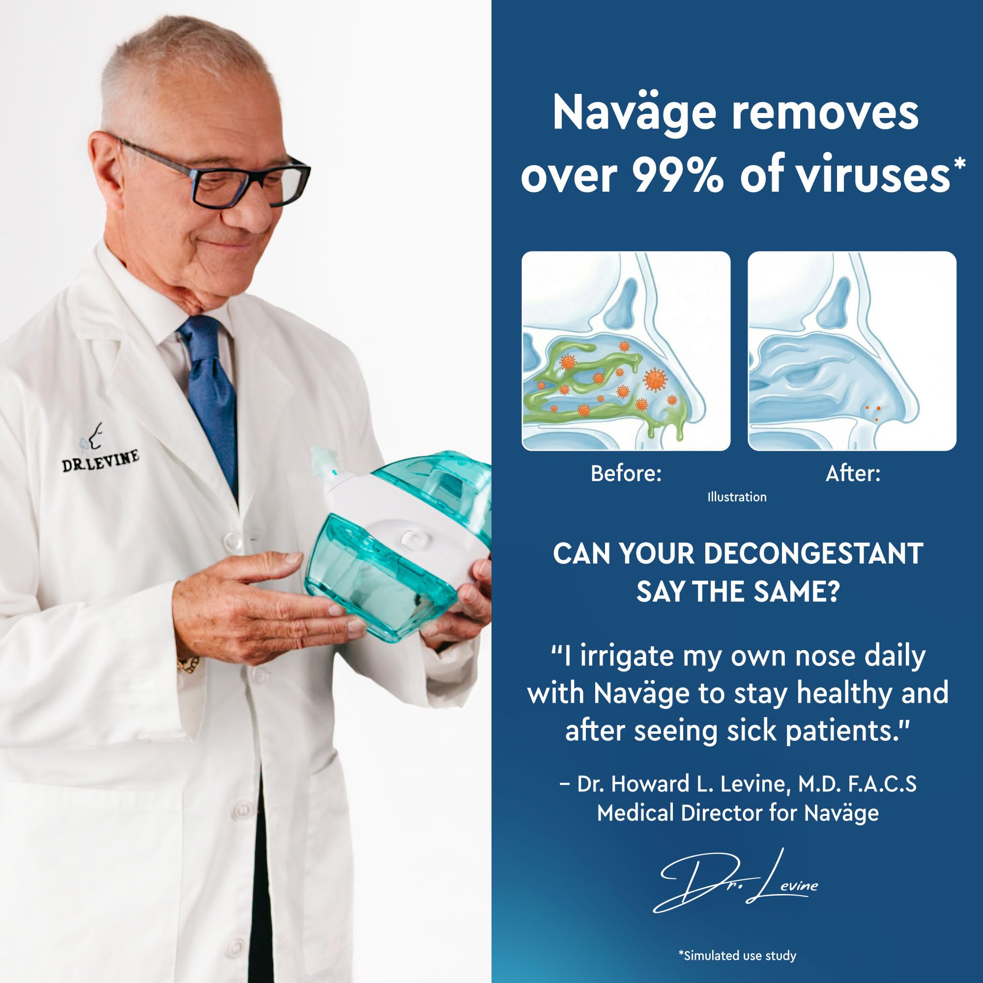 Two color coded nasal docks included with NAVAGE bundle