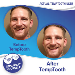 3D video instructions for Temptooth use
