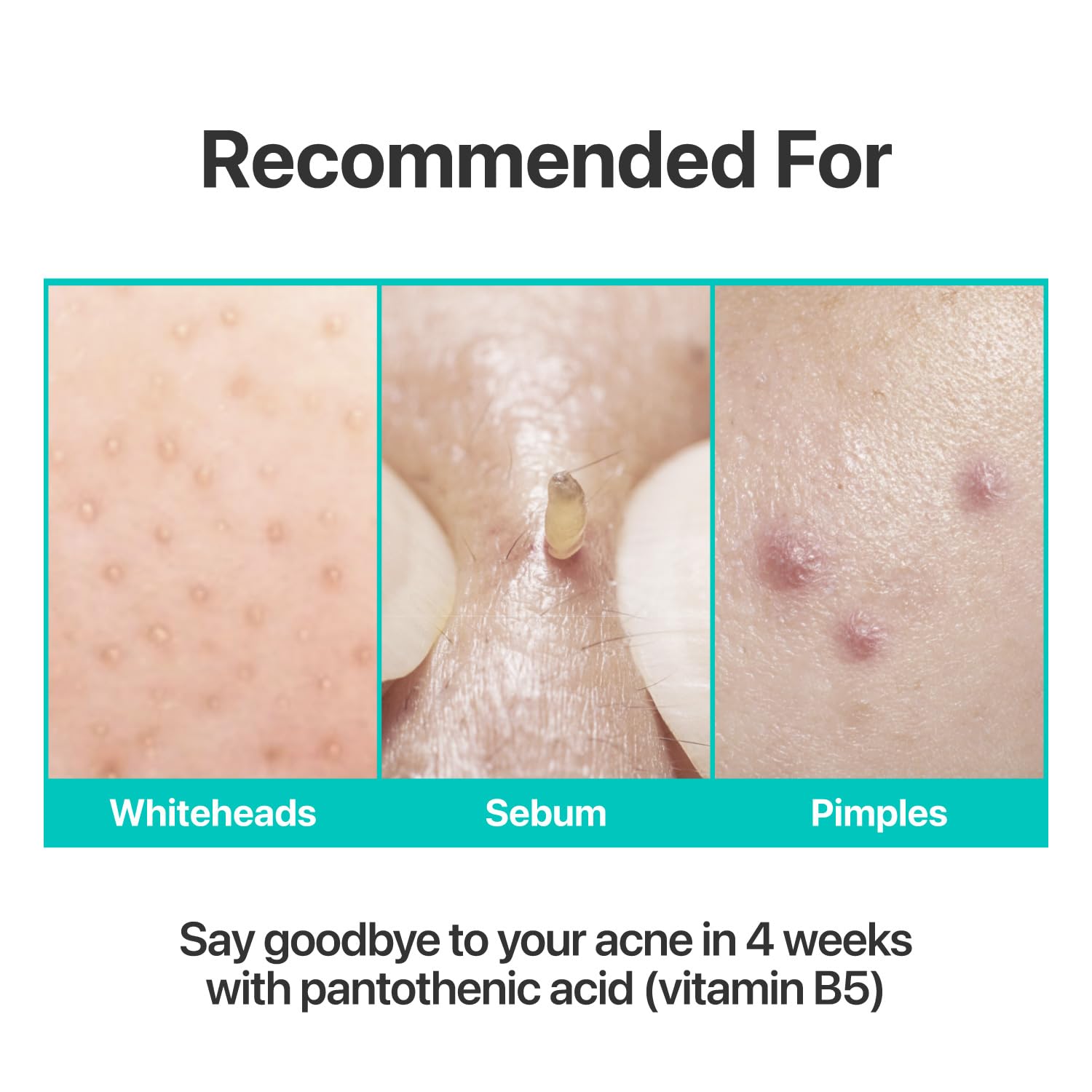 numbuzin No1 Pantothenic B5 Active Soothing Cream aczero sophora ingredients