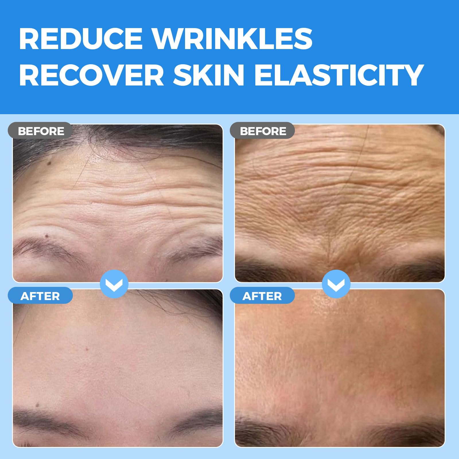 Okela forehead wrinkle patches overnight set