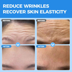 Okela forehead wrinkle patches overnight set