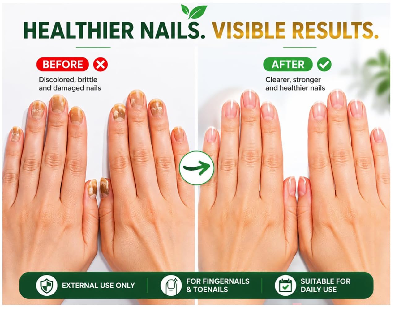 Oriundo Life Nail Treatment pack of 1 bottle