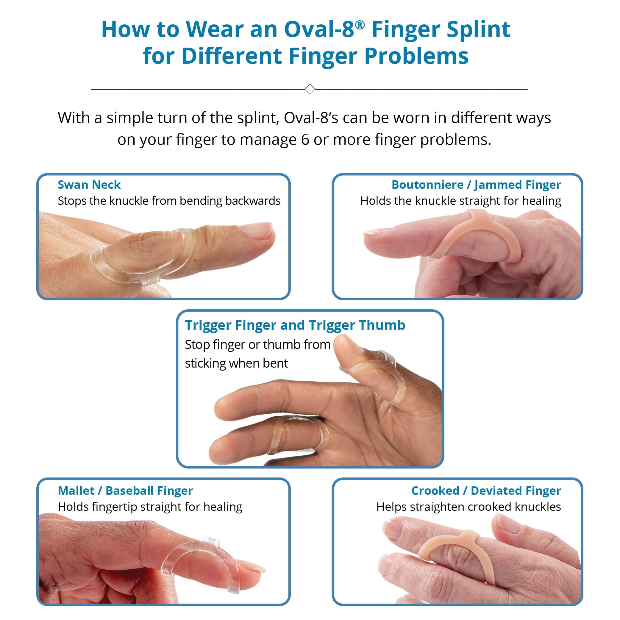 Oval-8 finger splint for mallet finger